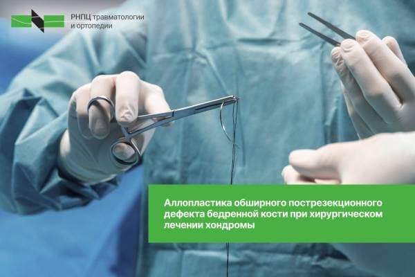 Аллопластика обширного пострезекционного дефекта бедренной кости при хирургическом  лечении хондромы